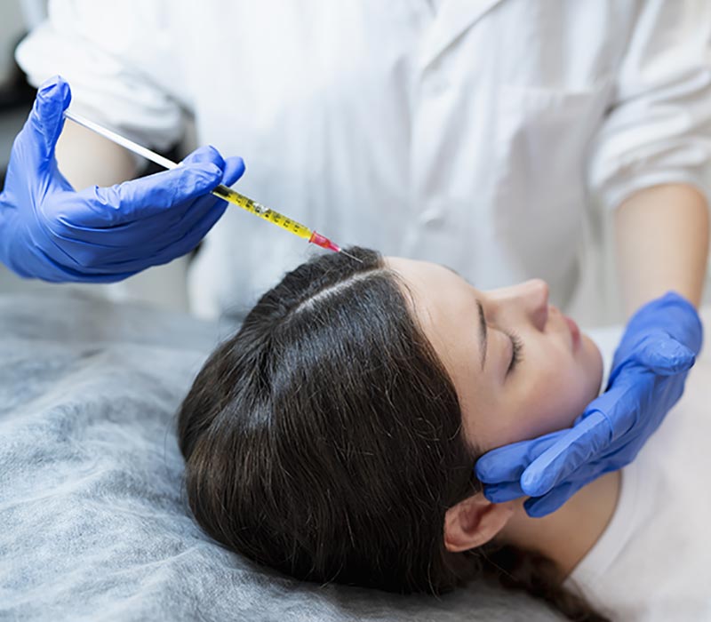 hair-prp-treatment-img1